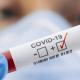 На 20 сентября 56 новых случев COVID-19 подтверждены в Орловской области На 20 сентября 56 новых случев COVID-19 подтверждены в Орловской области